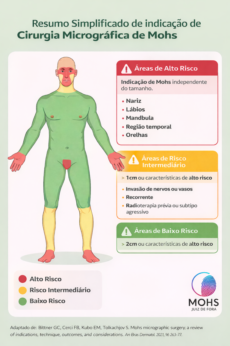 indicacoes de cirurgia micrográfica de Mohs Juiz de Fora